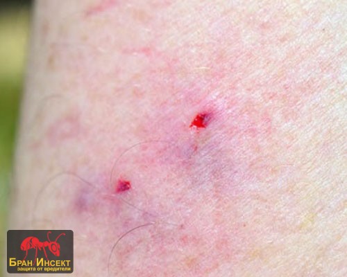 Първа помощ и спешни мерки при ухапване от змия - Бран Инсект